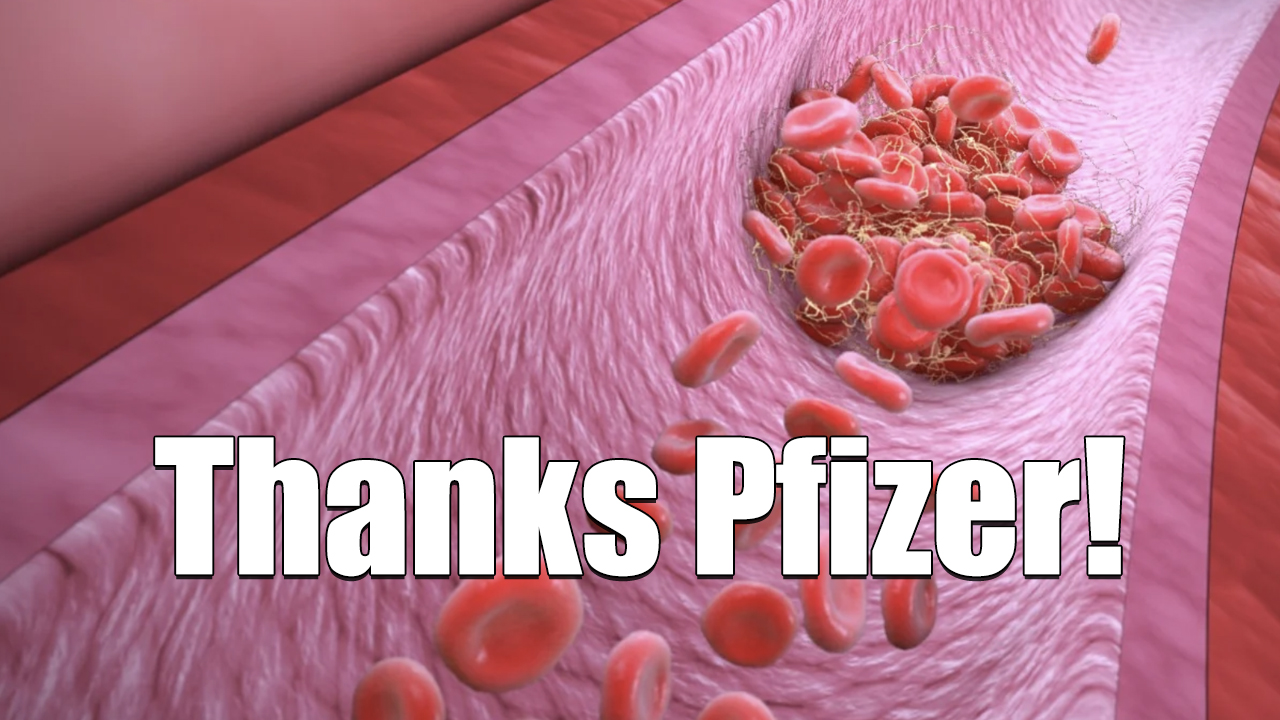 [PERHAPS YOU MISSED IT] Pfizer On Twitter Officially Acknowledging BLOOD CLOTS